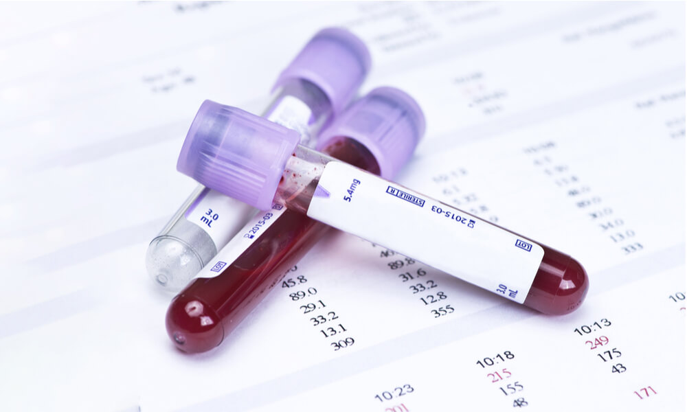 Простой анализ крови может предсказать риск развития в будущем диабета и сердечно-сосудистых заболеваний