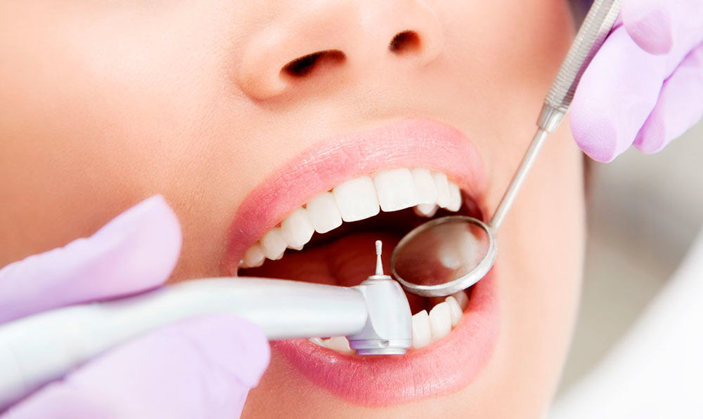 Зачем нужно лечить зубы: понимание важности здоровья полости рта